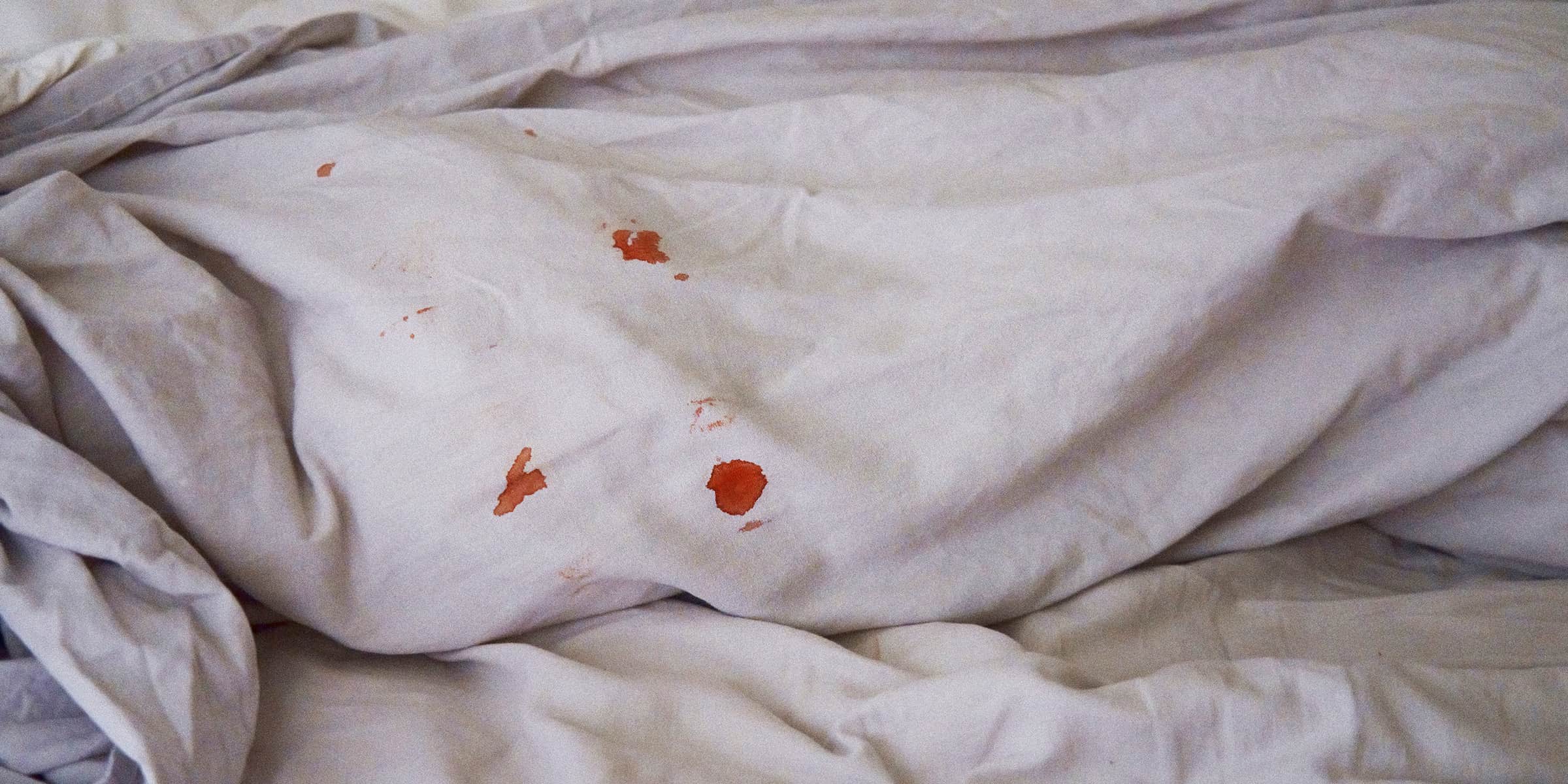 How to Get Blood Stains Out of Sheets Safely at Home